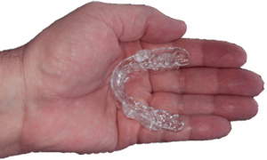 The Alternative to CPAP (CPAP Replacement) is Oral Appliance Therapy (Dental Mouthpiece), and it Fits in the Palm of your Hand!